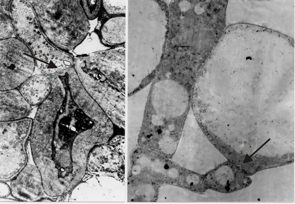 Transmission electron micrographs of differentiation across the dolipore septum in Coprinopsis cinerea