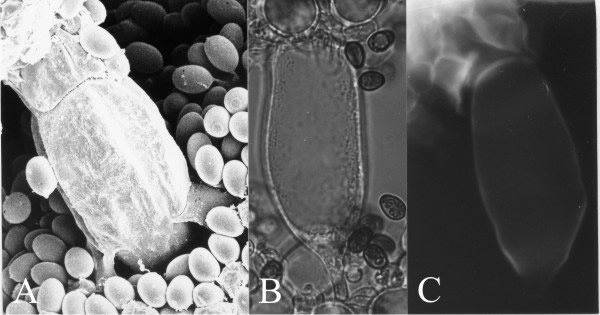 Cystidia and the adhesive cystesia of Coprinopsis cinerea