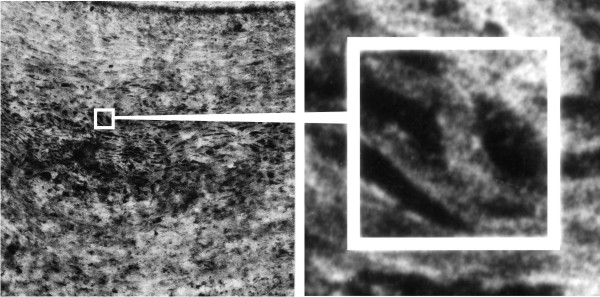 Magnified images of a longitudinal section of a secondarily-thickened wall showing its fibrillar structure