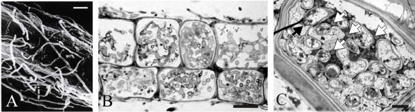 Cell biology of ericoid mycorrhizas