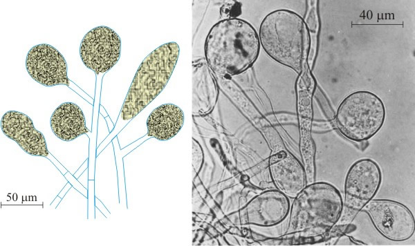 Diagram and micrograph of bromatia
