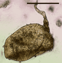 Light micrograph of a fossil fungal spore from the Ordovician period, 460 Mya