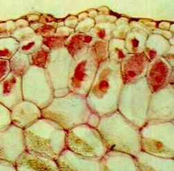 Orchid pelotons stained red in a light micrograph of sectioned tissue