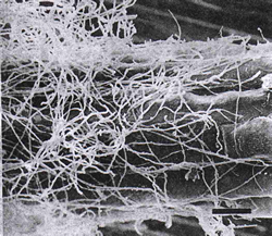 Surface weft of hyphae over Pyrola secunda root