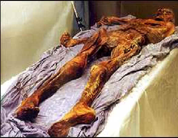 Ötzi, the Ice Man