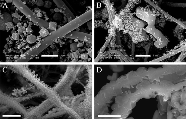 Photomicrographs of fungal hyphae showing examples of minerals formed by hyphal growth