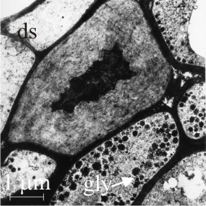 Secondarily-thickened walls of the central (medulla) region of a young sclerotium