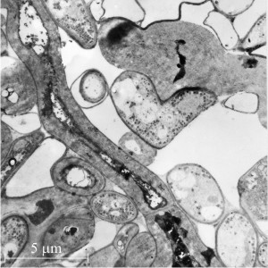 Medullary cells with secondarily-thickened wall shown in longitudinal section