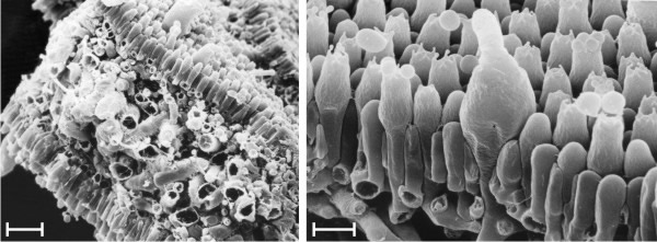 The mature gill of Volvariella bombycina in scanning electron microscope images