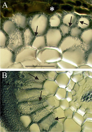 Light micrographs of hand sections of ectomycorrhizal forest trees cleared and stained with Chlorazol black E and viewed with interference contrast microscopy