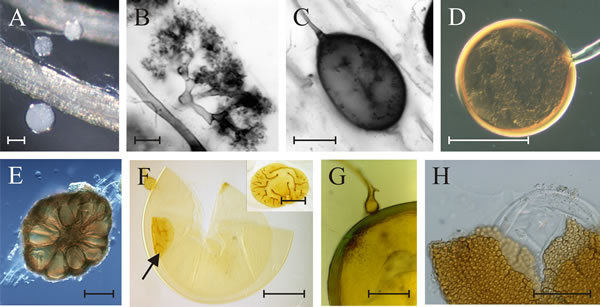 Some characteristic morphological features of glomeromycotan fungi