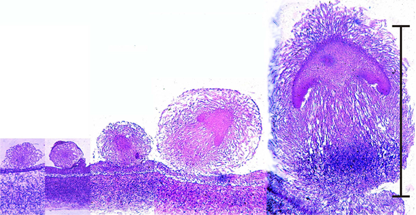 early mushroom development