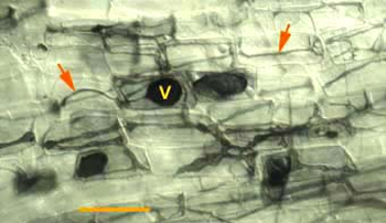 Vesicle with surrounding hyphae