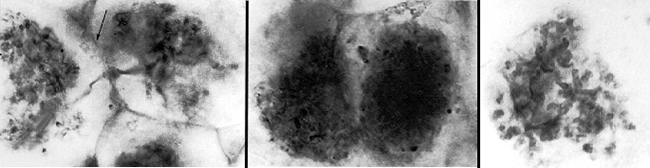 Fossil arbuscular mycorrhizas in Aglaophyton from the early Devonian